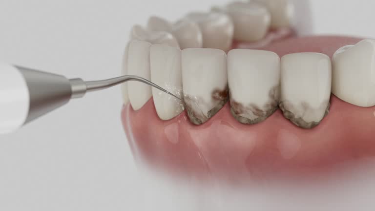 Trusted Wisdom Tooth Removal service in Colby, KS - Dentist Open Now